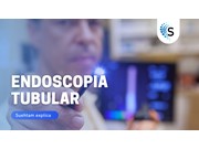 Endoscopia Tubular